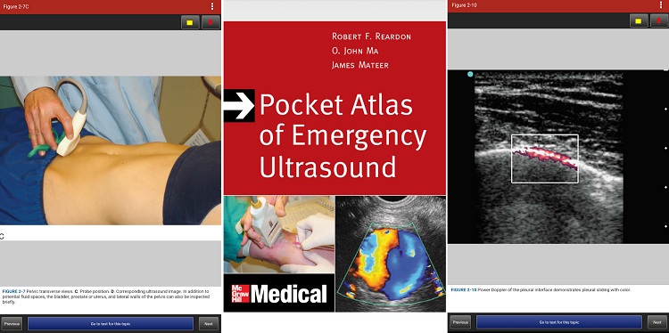 Pocket Atlas of ER Ultrasound