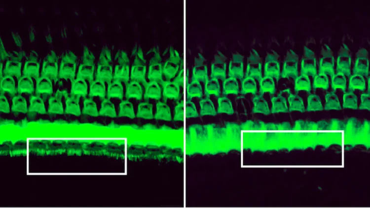 CRISPR Therapy Can Prevent Hearing Loss