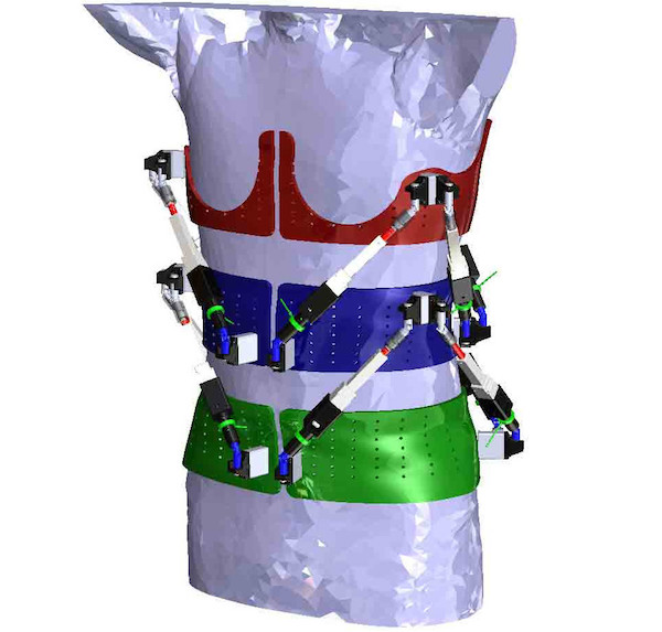 Robotic Spine Exoskeleton