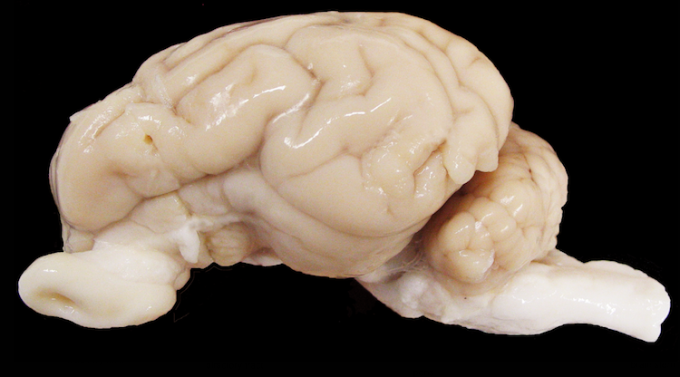 Scientists kept Pig Brains Alive