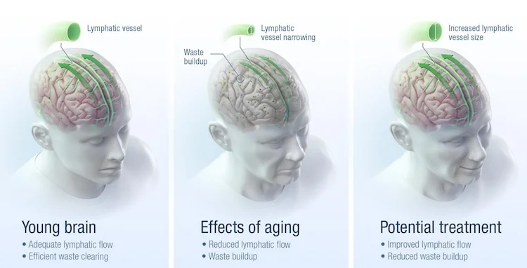 Improving Lymphatic Vessels to improve Learning and memory
