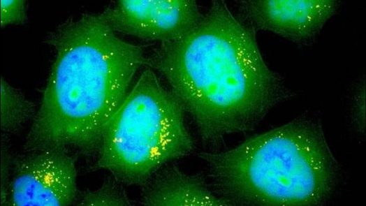 Inhalable Form of Messenger RNA
