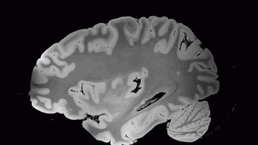 detailed view of human brain