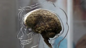 obesity could damage the brain