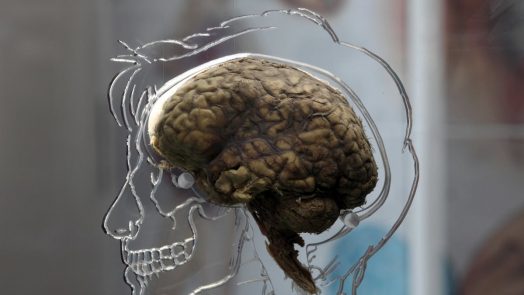 obesity could damage the brain