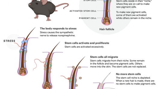how Stress Turns Hair Gray