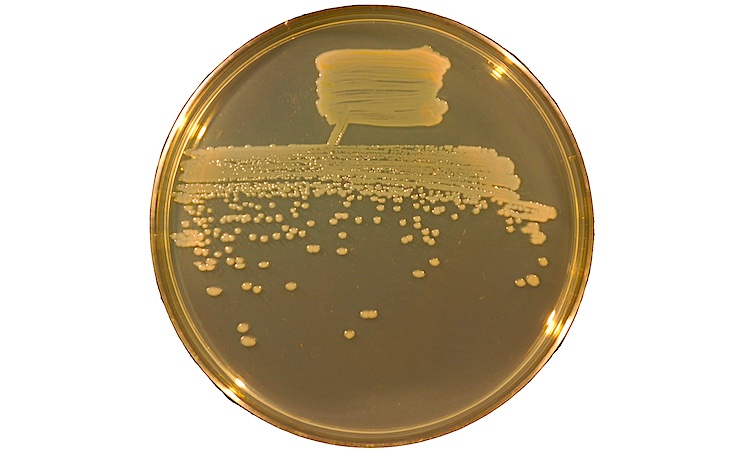 Бактерия Pseudomonas Fluorescens. Pseudomonas Fluorescens колония. Pseudomonas chlororaphis колонии. Pseudomonas Fluorescens препараты.